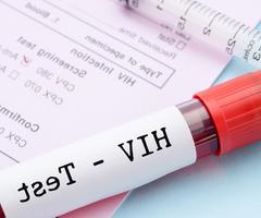 艾滋病毒检测应成为常规健康检查的一部分